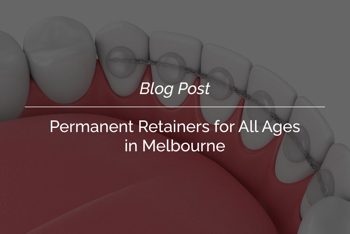 Permanent Retainers for All Ages in Melbourne