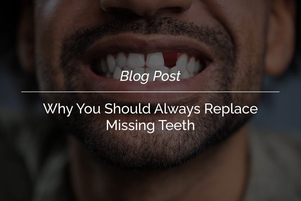 Why You Should Always Replace Missing Teeth